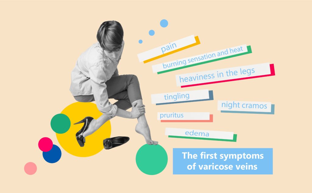 First,Symptoms,Of,Varicose,Veins.,Young,Woman,In,High,Heels