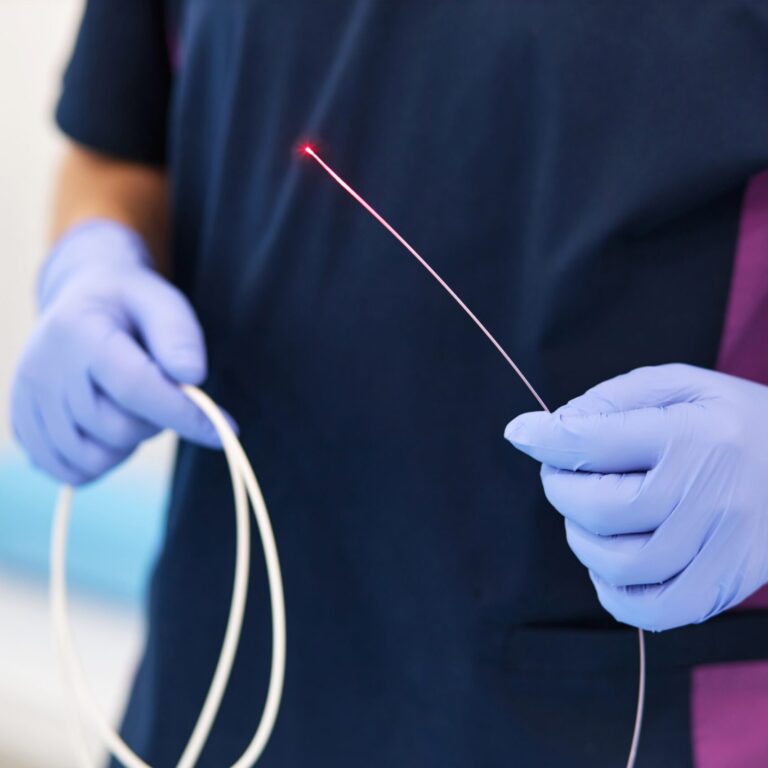 Endovenous ablation to treat varicose veins - chronic venous disease