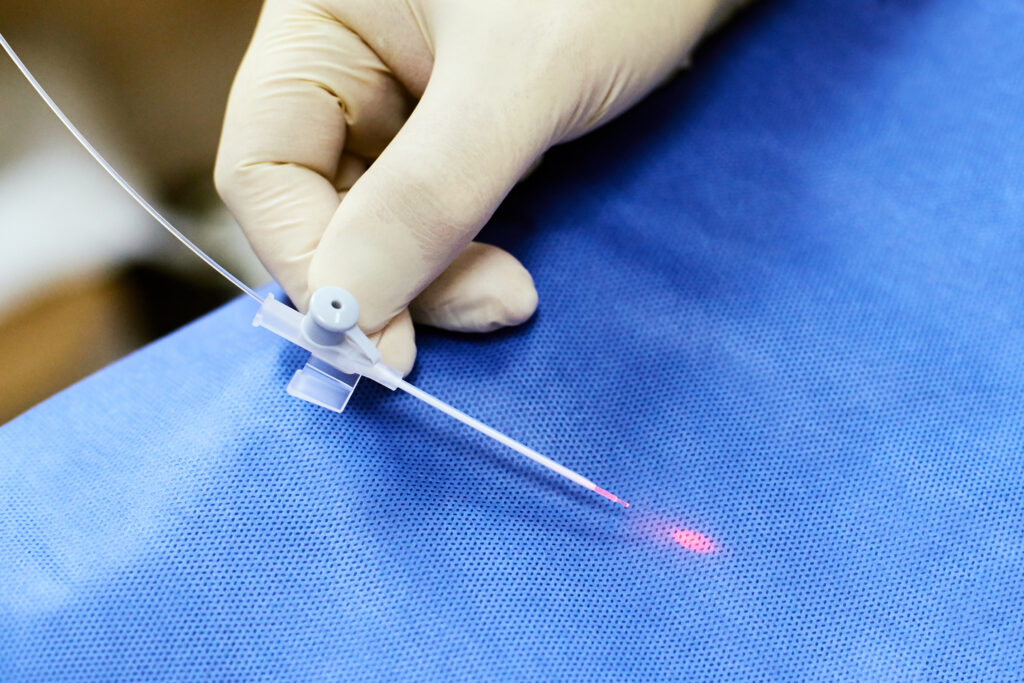 endovenous laser treatment