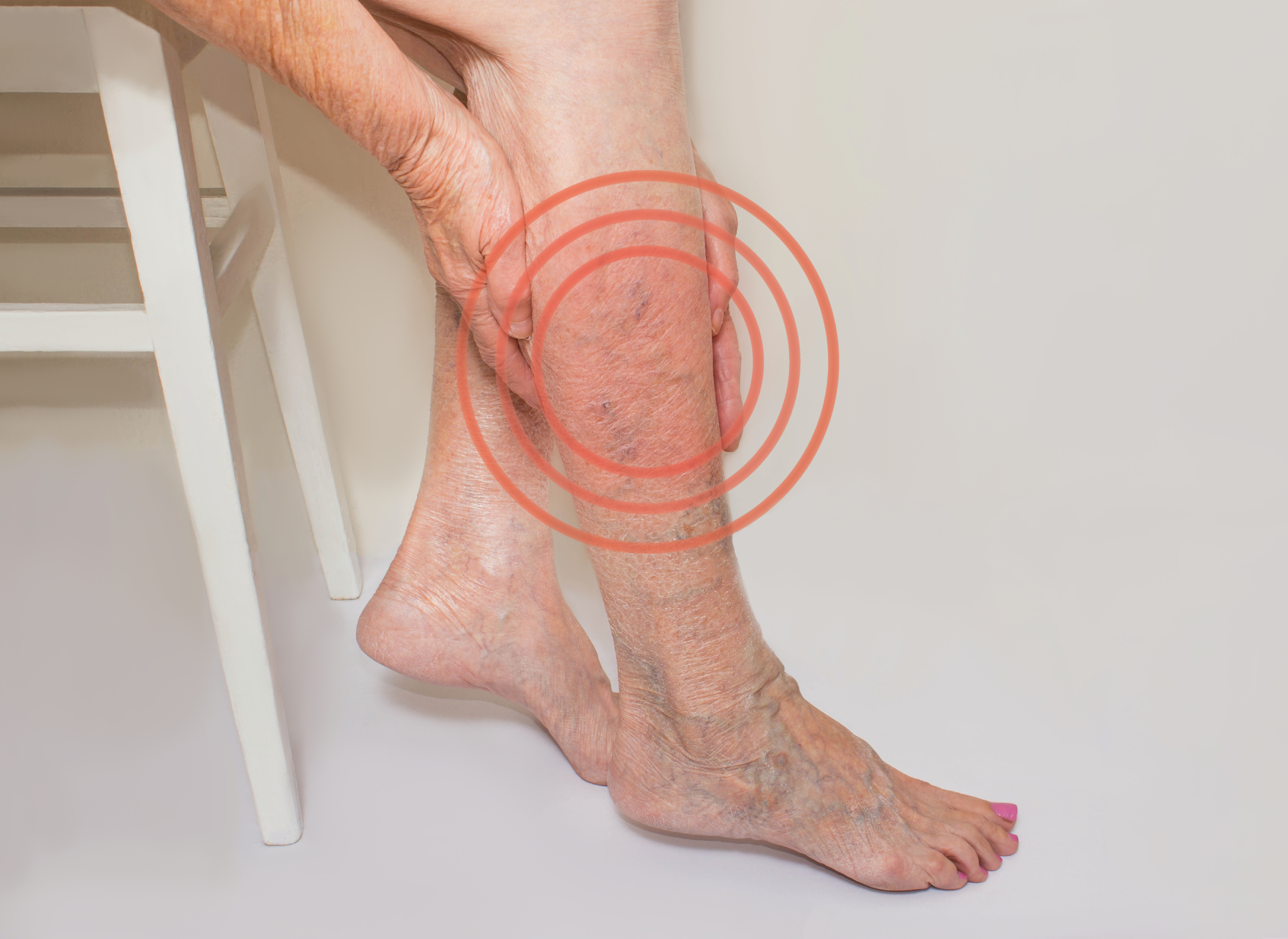 when to see a doctor for varicose veins
