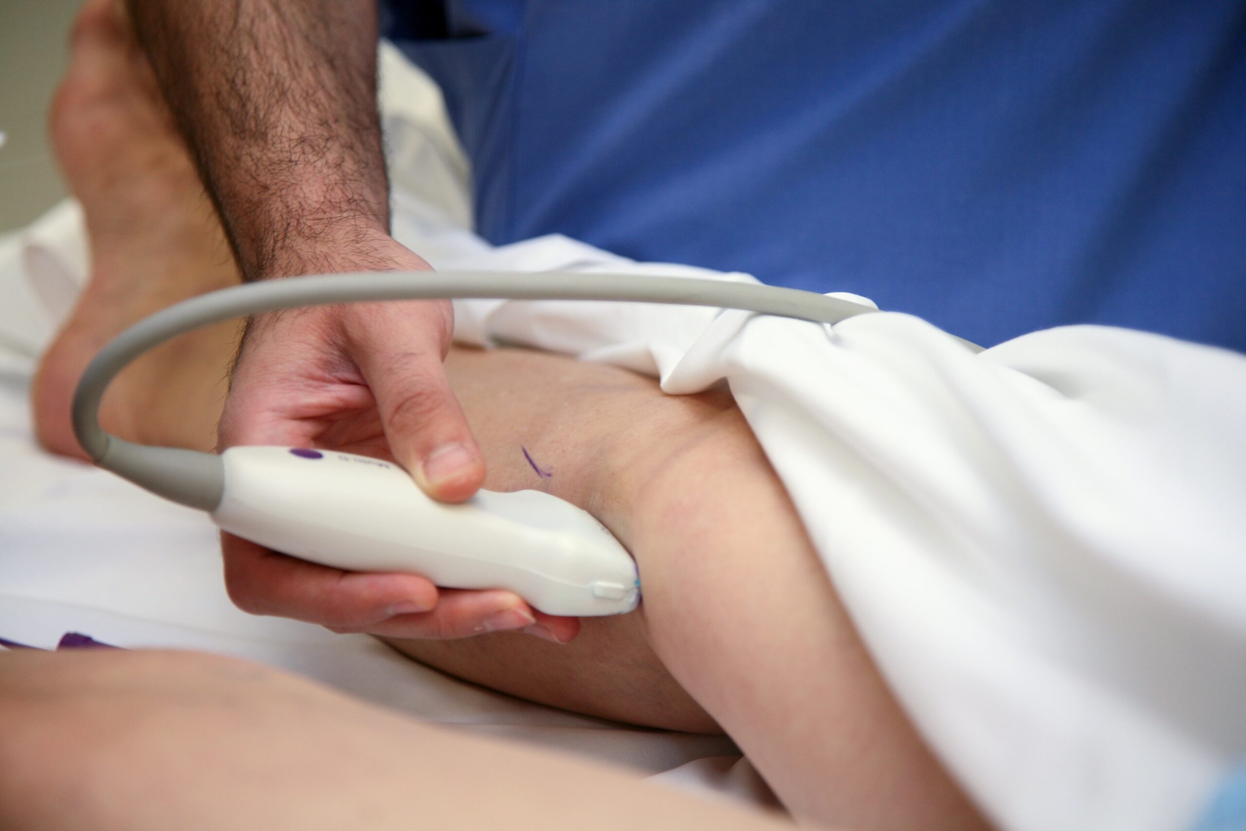 ultrasound check after applying medical glue in the vein