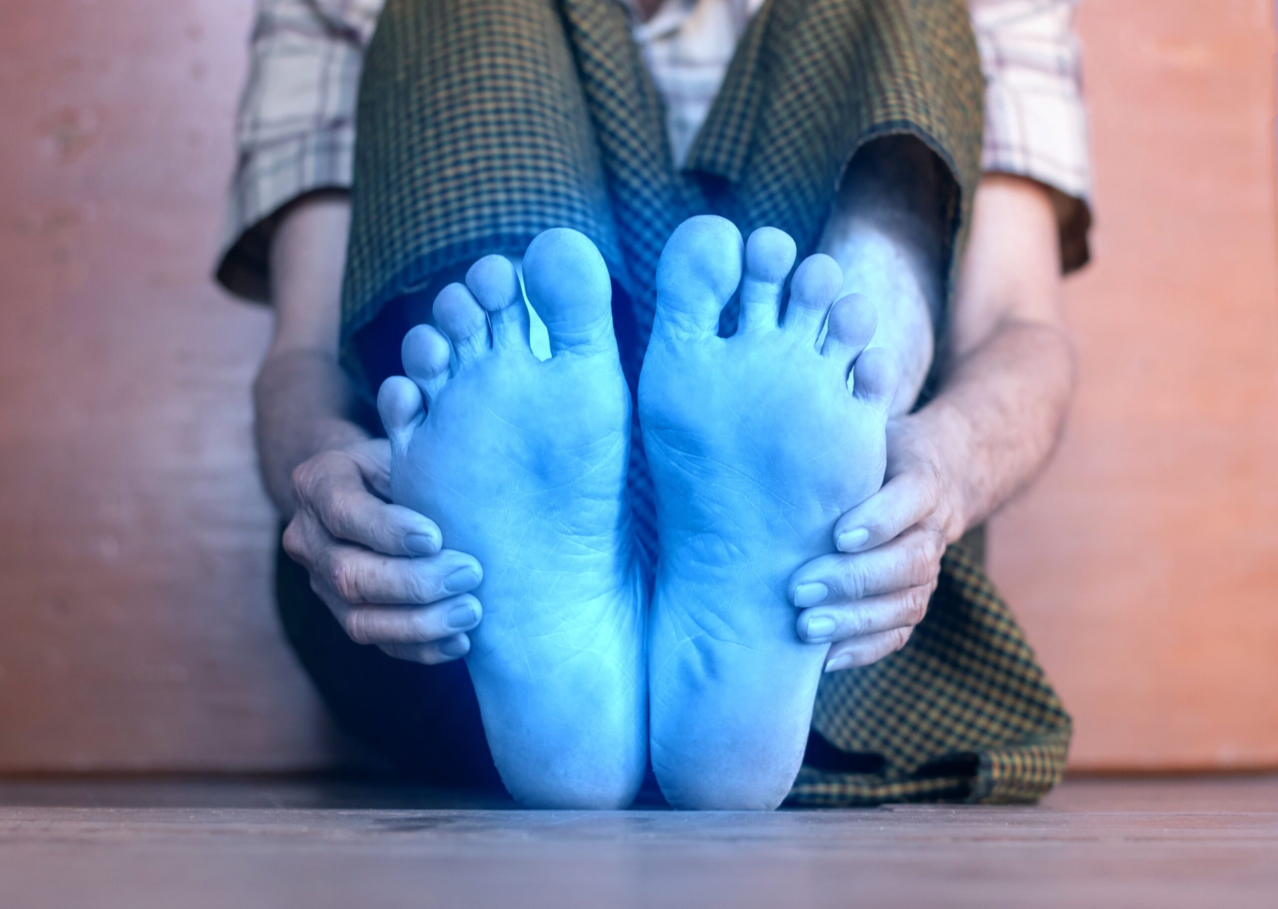 Light blue colored feet of Asian elder man. Concept of tingling and numbness or cold and clumsy foot.