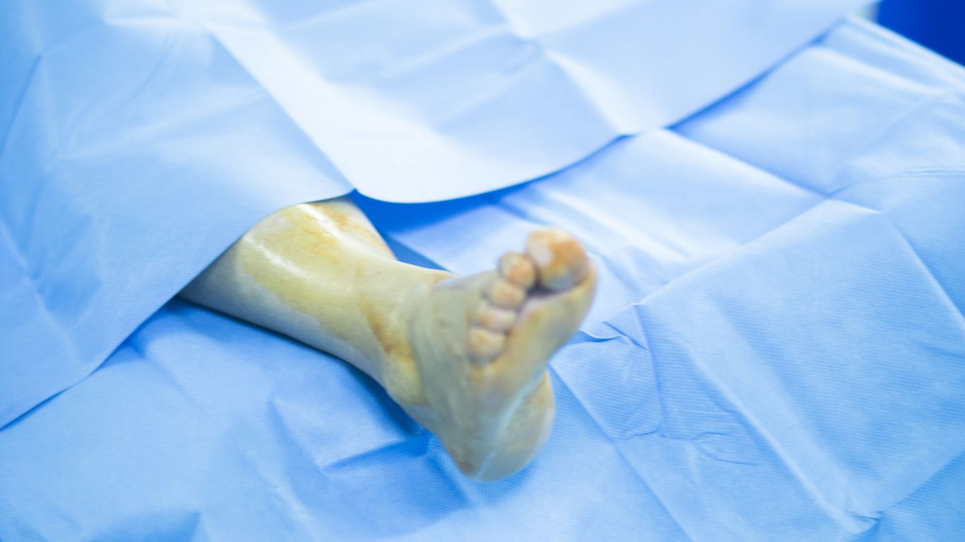What Causes Swollen Ankles Laurel Clinical what-causes-swollen-ankles-laurel-clinical