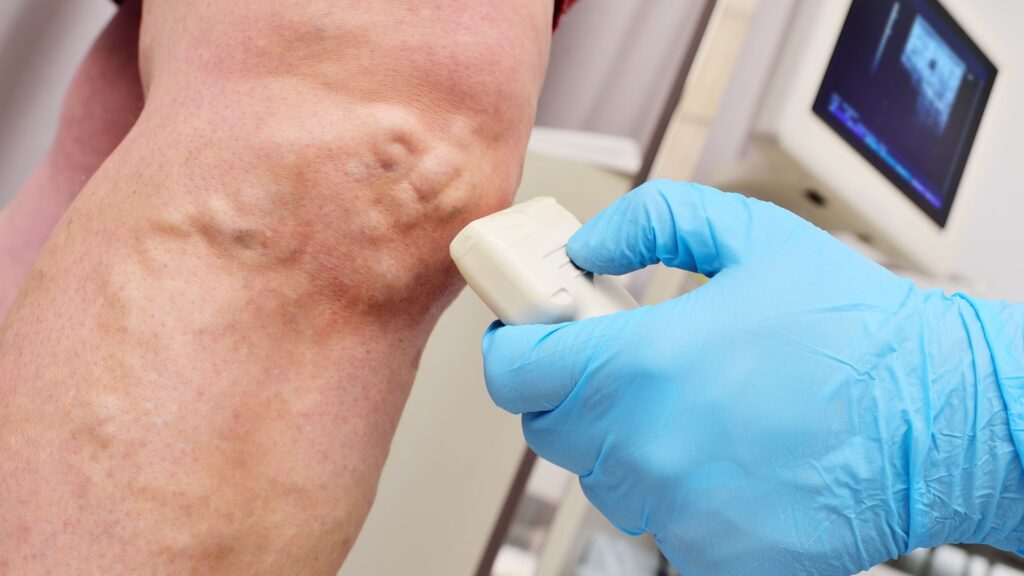 ultrasound on the veins of a patient