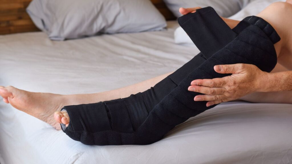 compression stocking on a lymphedema patient