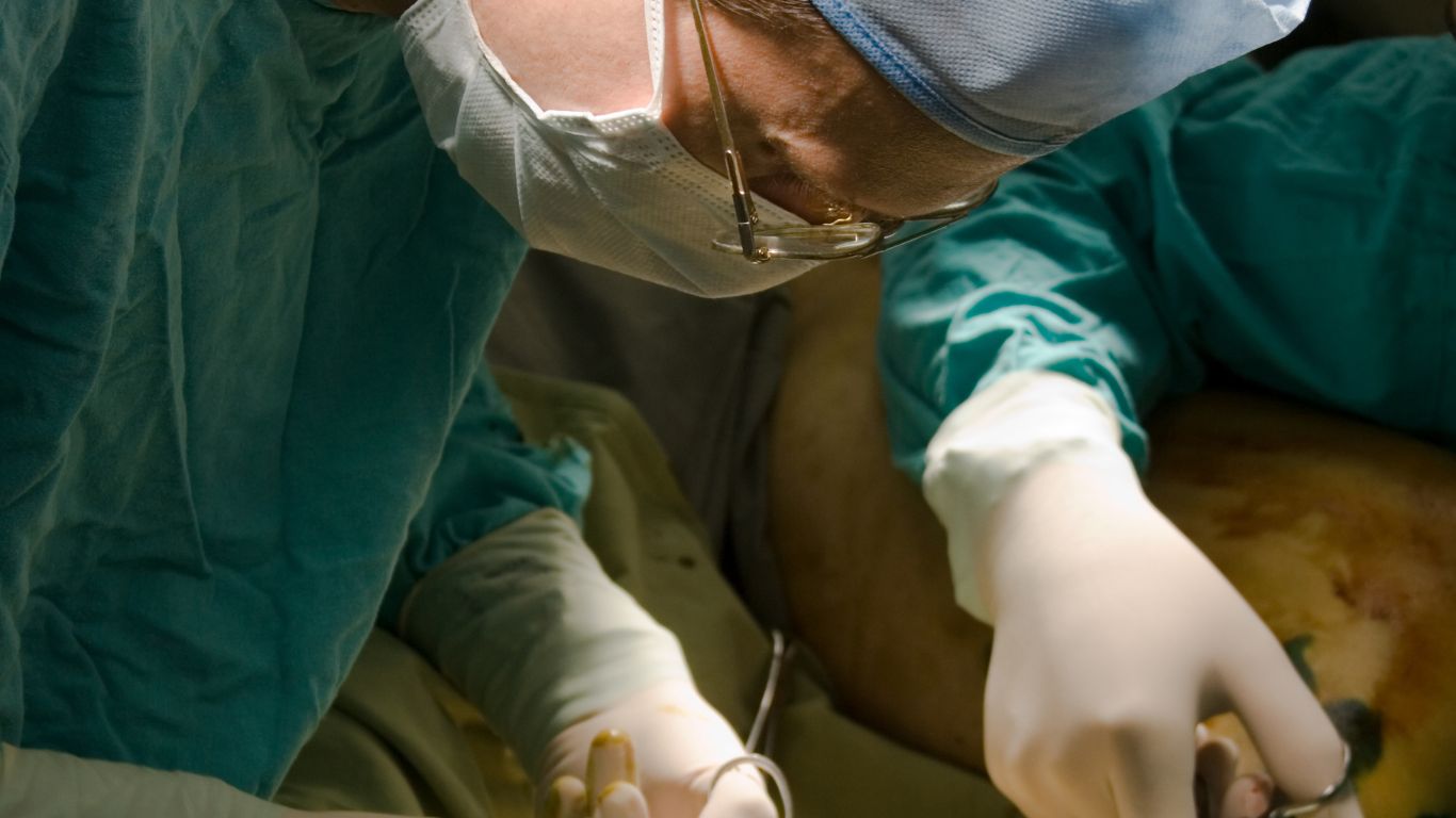 surgeon doing a surgical stripping