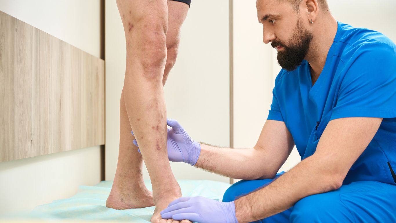 phlebologist analysing a vein with varicose veins