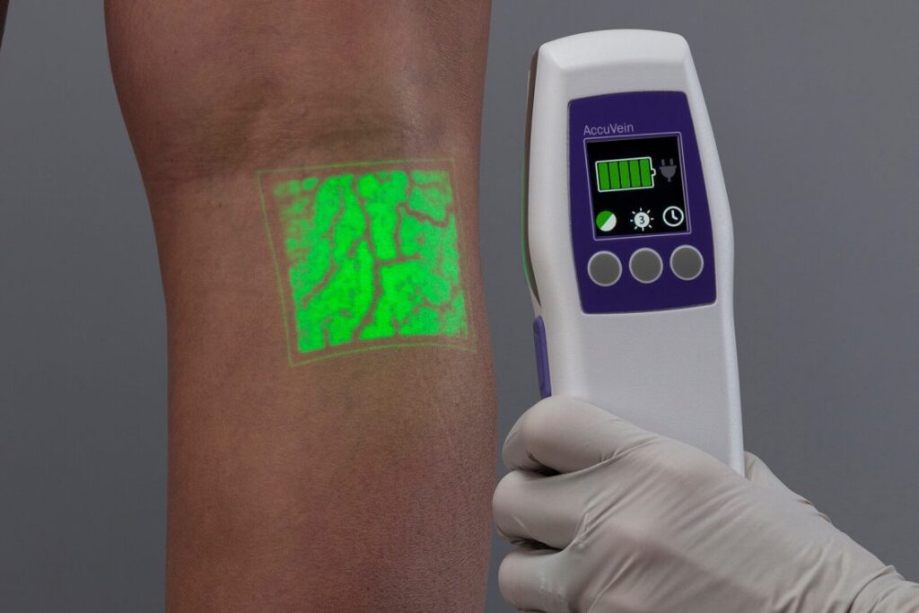 vein finder on the leg