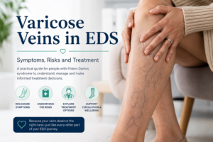 Learn how varicose veins may affect people with Ehlers-Danlos syndrome, which symptoms need attention and how EDS can influence treatment decisions.